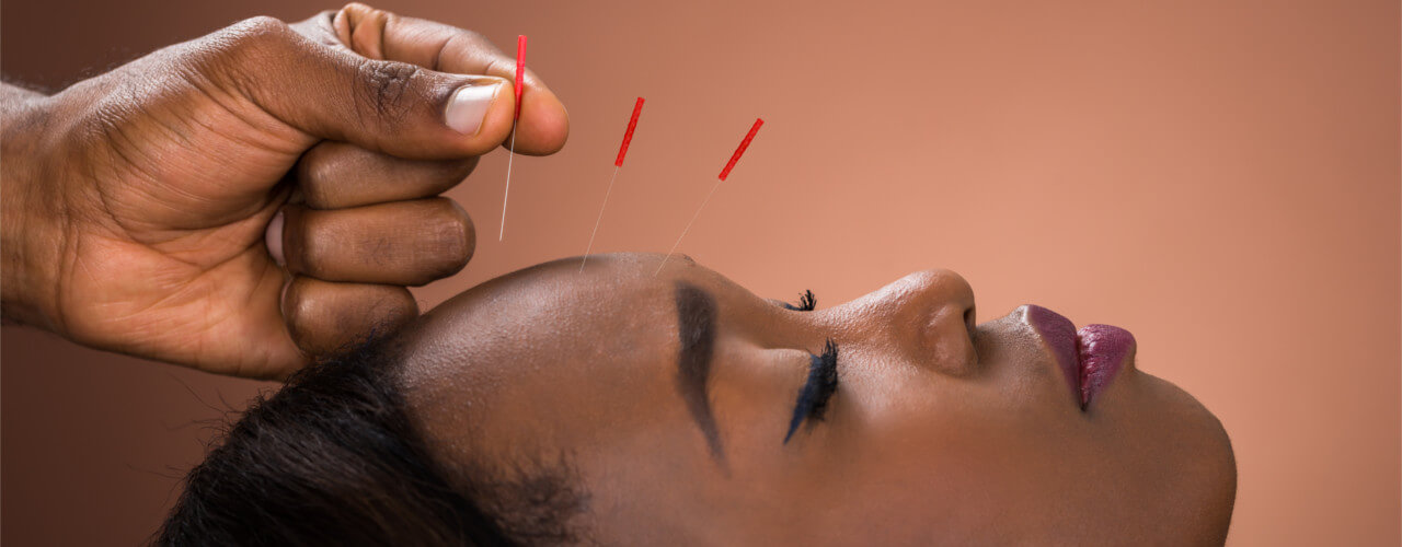 Dry Needling  Together Let's Start the Journey of Restoring You to Better  Health